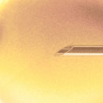 Tratamientos De Fertilidad